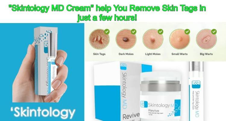 Skintology MD Reviews – Best Mole & Skin Tags Removal Cream, Ingredients